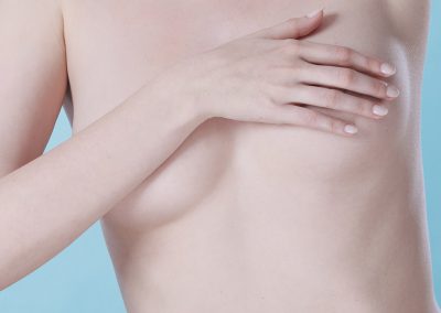 Areola and breast pigmentation